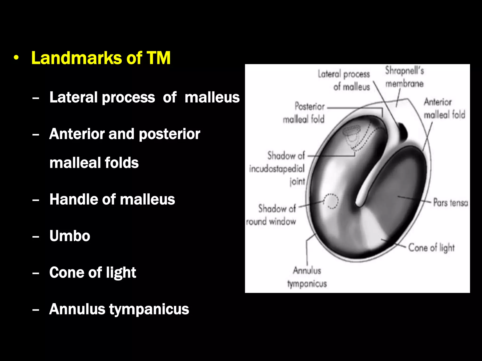 1. anatomy of ear and mastoid | PPT