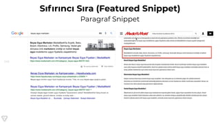 145
Sıfırıncı Sıra (Featured Snippet)
Paragraf Snippet
 