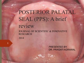 POSTERIOR PALATAL
SEAL (PPS): A brief
review
JOURNAL OF SCIENTIFIC & INNOVATIVE
RESEARCH
2014
1
PRESENTED BY,
DR. PRAGATI AGRAWAL
16
 