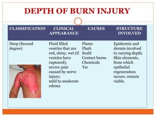 DEPTH OF BURN INJURY
CLASSIFICATION CLINICAL
APPEARANCE
CAUSES STRUCTURE
INVOLVED
Deep (Second
degree)
Fluid filled
vesicles that are
red, shiny, wet (if
vesicles have
ruptured);
severe pain
caused by nerve
injury;
mild to moderate
edema
Flame
Flash
Scald
Contact burns
Chemicals
Tar
Epidermis and
dermis involved
to varying depth.
Skin elements,
from which
epithelial
regeneration
occurs, remain
viable.
 