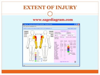 EXTENT OF INJURY
www.sagediagram.com
 