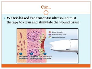 Con..
 Water-based treatments: ultrasound mist
therapy to clean and stimulate the wound tissue.
 