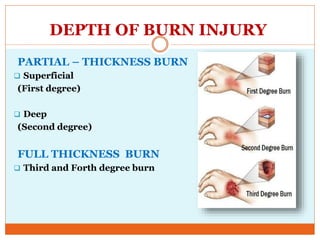 DEPTH OF BURN INJURY
PARTIAL – THICKNESS BURN
 Superficial
(First degree)
 Deep
(Second degree)
FULL THICKNESS BURN
 Third and Forth degree burn
 