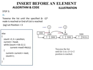 ALGORITHM & CODE
STEP 3:
iii.
Traverse the list until the specified (k -1)th
node is reached or End of List is reached
(eg) Let Position = 3
ILLUSTRATION
INSERT BEFORE AN ELEMENT
else
{
count =1; k = position;
current = head;
while (count <=(k-1) ||
current->next!=NULL)
{
current= current-> next;
count++;
}
}
 