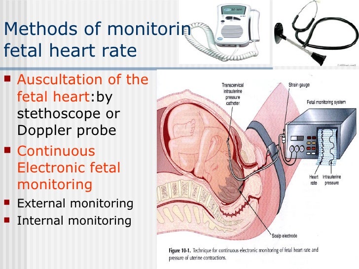 1 2009 Fetal Surveillance During Labor