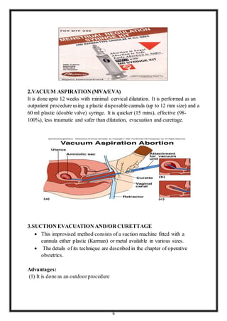 MTP- Medical Termination Pregnancy word File | DOCX