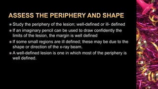 Principles of Radiographic Interpretations | PPTX