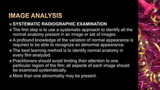 Principles of Radiographic Interpretations | PPTX
