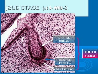 ((BBUUDD SSTTAAGGEE ((aatt 88-- WWIIUU--22 
DENTAL 
ORGAN 
DENTAL 
PAPILLA 
DENTAL SAC 
TOOTH 
GERM 
 