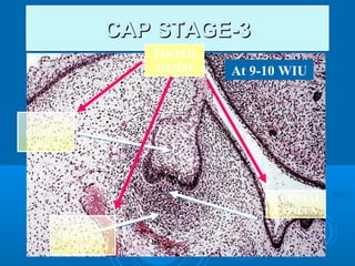 CCAAPP SSTTAAGGEE--33 
TOOTH 
GERM At 9-10 WIU 
1- 
DENTAL 
ORGAN 
2- DENTAL 
PAPILLA 
3- 
DENTAL 
SAC 
 