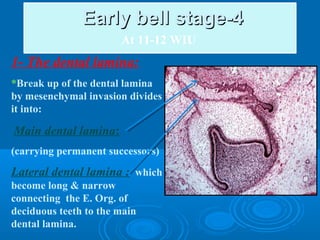 EEaarrllyy bbeellll ssttaaggee--44 
At 11-12 WIU 
1- The dental lamina: 
*Break up of the dental lamina 
by mesenchymal invasion divides 
it into: 
Main dental lamina: 
(carrying permanent successors) 
Lateral dental lamina : which 
become long & narrow 
connecting the E. Org. of 
deciduous teeth to the main 
dental lamina. 
 