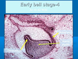 EEaarrllyy bbeellll ssttaaggee--44 
Dental 
papilla 
At 11-12 WIU 
Odontoblasts 
Dental sac 
 