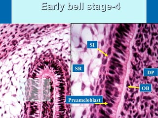 EEaarrllyy bbeellll ssttaaggee--44 
SR 
SI 
Preameloblast 
DP 
OB 
 