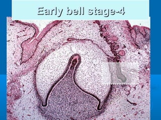 EEaarrllyy bbeellll ssttaaggee--44 
 