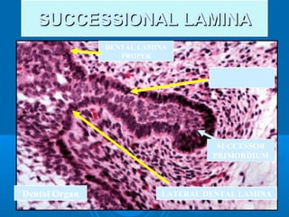 SSUUCCCCEESSSSIIOONNAALL LLAAMMIINNAA 
DENTAL LAMINA 
PROPER 
SUCCESSIONAL 
LAMINA 
LATERAL DENTAL LAMINA 
Dental Organ 
SUCCESSOR 
PRIMORDIUM 
 