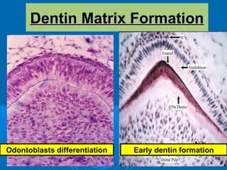 DDeennttiinn MMaattrriixx FFoorrmmaattiioonn 
Odontoblasts differentiation Early dentin formation 
 