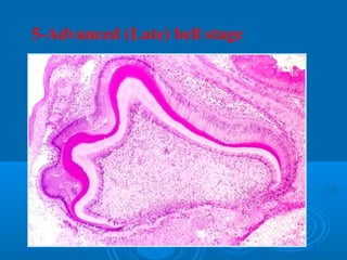 5-Advanced (Late) bell stage 
 