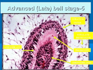 AAddvvaanncceedd ((LLaattee)) bbeellll ssttaaggee--55 
STRATUM 
INTER. 
STELLATE 
RETICULUM 
PREDENTIN 
ODONTOBLASTS 
AMELOBLAST 
 