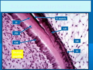 5-Advanced (Late) bell Stage 
D 
PD 
OB 
Dental 
papilla 
E matrix 
SR 
SI 
AB 
 