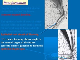 Root formation 
Begins when the enamel & dentin 
formation reaches the future 
cemento-enamel junction. 
The epithelial cells of inner & outer 
enamel epithelium proliferate from 
the cervical loop to form a double 
epith. membrane known as 
Epithelial root sheath of Hertwig. 
* It bends forming obtuse angle to 
the enamel organ at the future 
cemento-enamel junction to form the 
epithelial diaphragm. 
 