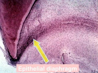 Epithelial diaphragm 
 