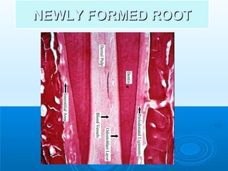 NNEEWWLLYY FFOORRMMEEDD RROOOOTT 
 