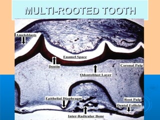 MMUULLTTII--RROOOOTTEEDD TTOOOOTTHH 
 