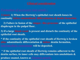 Clinical consideration 
Formation of accessory root canals : 
Causes: 1) When the Hertwig’s epithelial root sheath looses its 
continuity before odontoblastic differentiation & dentin formation. 
2) Failure in fusion of the tongue –like processes of the epithelial 
diaphragm in the pulpal floor. 
3) If a large blood vessel is present and disturb the continuity of the 
epithelial root sheath. 
* If the continuity of the epithelial root sheath of Hertwig is broken 
after odontoblastic differentiation & before dentin formation, 
intermediate cementum will be deposited. 
* if the epithelial root sheath of Hertwig remains adherent to the 
dentin surface, its inner cells may differentiate into ameloblasts & 
produce enamel, known as Enamel pearls. 
 