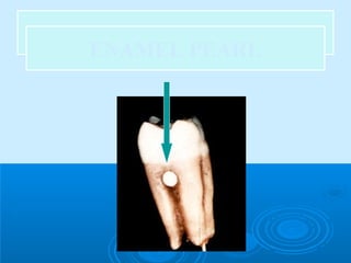 EENNAAMMEELL PPEEAARRLL ENAMEL PEARL 
 