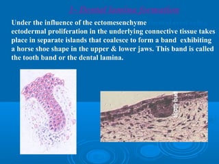 1- Dental lamina formation 
Under the influence of the ectomesenchyme (neural crest cells), 
ectodermal proliferation in the underlying connective tissue takes 
place in separate islands that coalesce to form a band exhibiting 
a horse shoe shape in the upper & lower jaws. This band is called 
the tooth band or the dental lamina. 
 
