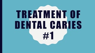 TREATMENT OF
DENTAL CARIES
#1
 