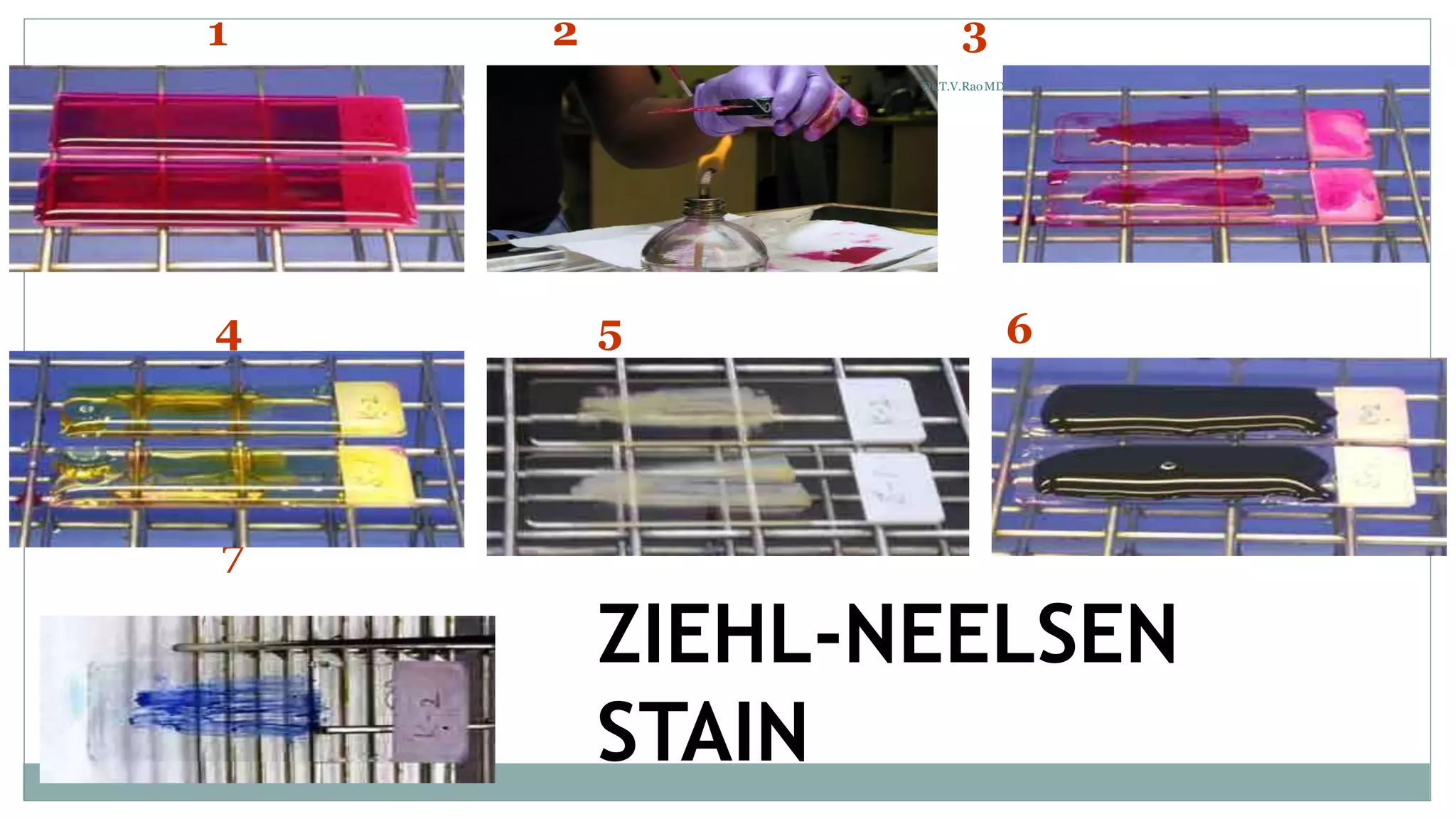 INTRODUCTION TO MICRO LAB, STAINING TECHNIQUES & MORPHOLOGY OF BACTERIA