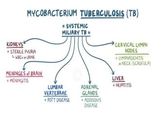 Tuberculosis | PPTX