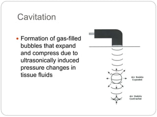 Cavitation
 Formation of gas-filled
bubbles that expand
and compress due to
ultrasonically induced
pressure changes in
tissue fluids
 