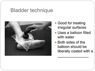 Bladder technique
 Good for treating
irregular surfaces
 Uses a balloon filled
with water
 Both sides of the
balloon should be
liberally coated with a
_______________
 
