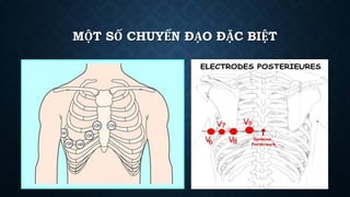MỘT SỐ CHUYỂN ĐẠO ĐẶC BIỆT
 
