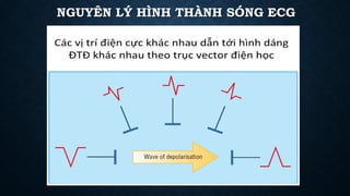 NGUYÊN LÝ HÌNH THÀNH SÓNG ECG
 