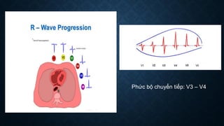 Phức bộ chuyển tiếp: V3 – V4
 