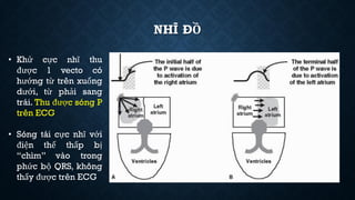 NHĨ ĐỒ
• Khử cực nhĩ thu
được 1 vecto có
hướng từ trên xuống
dưới, từ phải sang
trái. Thu được sóng P
trên ECG
• Sóng tái cực nhĩ với
điện thế thấp bị
“chìm” vào trong
phức bộ QRS, không
thấy được trên ECG
 