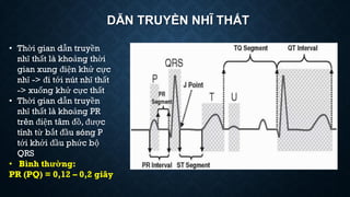 DẪN TRUYỀN NHĨ THẤT
• Thời gian dẫn truyền
nhĩ thất là khoảng thời
gian xung điện khử cực
nhĩ -> đi tới nút nhĩ thất
-> xuống khử cực thất
• Thời gian dẫn truyền
nhĩ thất là khoảng PR
trên điện tâm đồ, được
tính từ bắt đầu sóng P
tới khởi đầu phức bộ
QRS
• Bình thường:
PR (PQ) = 0,12 – 0,2 giây
 
