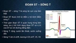 ĐOẠN ST – SÓNG T
• Đoạn ST – sóng T là sóng tái cực của tâm
thất
• Đoạn ST được tính từ điểm J tới khởi điểm
sóng T
• Thời gian đoạn ST ít quan trọng trong lâm
sàng, lưu ý tới hình dạng đoạn ST và vị trí
của ST so với đường đẳng điện.
• Sóng T: rộng, sườn lên thoải, sườn xuống
dốc
• Sóng T: âm ở aVR, dương ở DI aVF, V5, V6
 