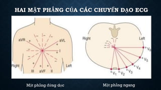 HAI MẶT PHẲNG CỦA CÁC CHUYỂN ĐẠO ECG
Mặt phẳng đứng dọc Mặt phẳng ngang
 