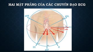 HAI MẶT PHẲNG CỦA CÁC CHUYỂN ĐẠO ECG
 
