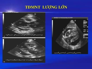 TDMNT LÖÔÏNG LÔÙN
◼
 