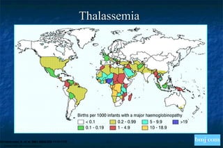 Copyright ©2004 BMJ Publishing Group Ltd.
Christianson, A. et al. BMJ 2004;329:1115-1117
Thalassemia
 