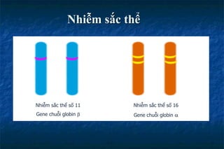 Nhiễm sắc thể
Nhiễm sắc thể số 11
Gene chuỗi globin 
Nhiễm sắc thể số 16
Gene chuỗi globin 
 