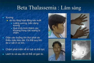 Beta Thalassemia : Lâm sàng
 Xương
 do tủy tăng hoạt động sản xuất
 Loãng xương, biến dạng
xương
 Quá trình hình thành các
khoang trong các xoang bị
chậm.
 Giãn các buồng tim thứ phát do
thiếu máu kéo dài. Có thể suy tim
do ứ sắt ở cơ tim.
 Chậm phát triển về trí tuệ và thể lực
 Lách to và sau đó có thể có gan to.
 