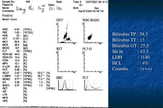 Bilirubin TP : 38,5
Bilirubin TT : 13
Bilirubin GT : 25,5
S¾t ht : 43,5
LDH : 1140
HCL : 4%
Coombs : (+++)
 