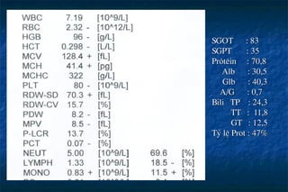 SGOT : 83
SGPT : 35
Pr«tªin : 70,8
Alb : 30,5
Glb : 40,3
A/G : 0,7
Bili TP : 24,3
TT : 11,8
GT : 12,5
Tû lÖ Prot : 47%
 