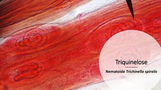 Triquinelose
Nematoide Trichinella spiralis
 